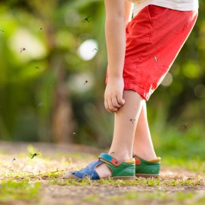 mosquito,on,kids,skin.,little,boy,attacked,by,mosquitoes,in